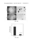 Angiogenin and Variants Thereof for Treatment of Neurodegenerative     Diseases diagram and image