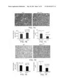 Angiogenin and Variants Thereof for Treatment of Neurodegenerative     Diseases diagram and image