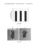 Angiogenin and Variants Thereof for Treatment of Neurodegenerative     Diseases diagram and image