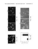 Angiogenin and Variants Thereof for Treatment of Neurodegenerative     Diseases diagram and image