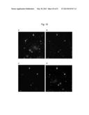 ANTI-AMYLOID BETA ANTIBODIES AND THEIR USE diagram and image