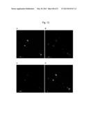 ANTI-AMYLOID BETA ANTIBODIES AND THEIR USE diagram and image