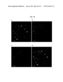 ANTI-AMYLOID BETA ANTIBODIES AND THEIR USE diagram and image