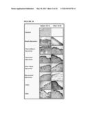 PTEROSTILBENE (PTER) FOR USE IN THE PREVENTION AND/OR TREATMENT OF SKIN     DISEASES, DAMAGES OR INJURIES diagram and image