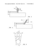 SELECTIVE LASER MELTING / SINTERING USING POWDERED FLUX diagram and image