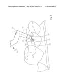 Dental Tools for Photo-Curing of Dental Fillings diagram and image