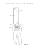 Dental Tools for Photo-Curing of Dental Fillings diagram and image