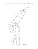 Dental Tools for Photo-Curing of Dental Fillings diagram and image