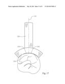 Dental Tools for Photo-Curing of Dental Fillings diagram and image