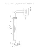 Dental Tools for Photo-Curing of Dental Fillings diagram and image