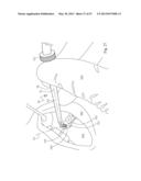 Dental Tools for Photo-Curing of Dental Fillings diagram and image