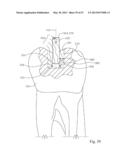 Dental Tools for Photo-Curing of Dental Fillings diagram and image