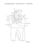 Dental Tools for Photo-Curing of Dental Fillings diagram and image