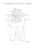 Dental Tools for Photo-Curing of Dental Fillings diagram and image