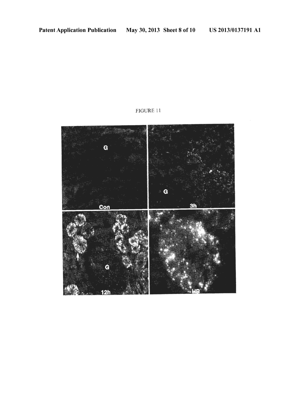 METHOD AND KIT FOR DETECTING THE EARLY ONSET OF RENAL TUBULAR CELL INJURY - diagram, schematic, and image 09