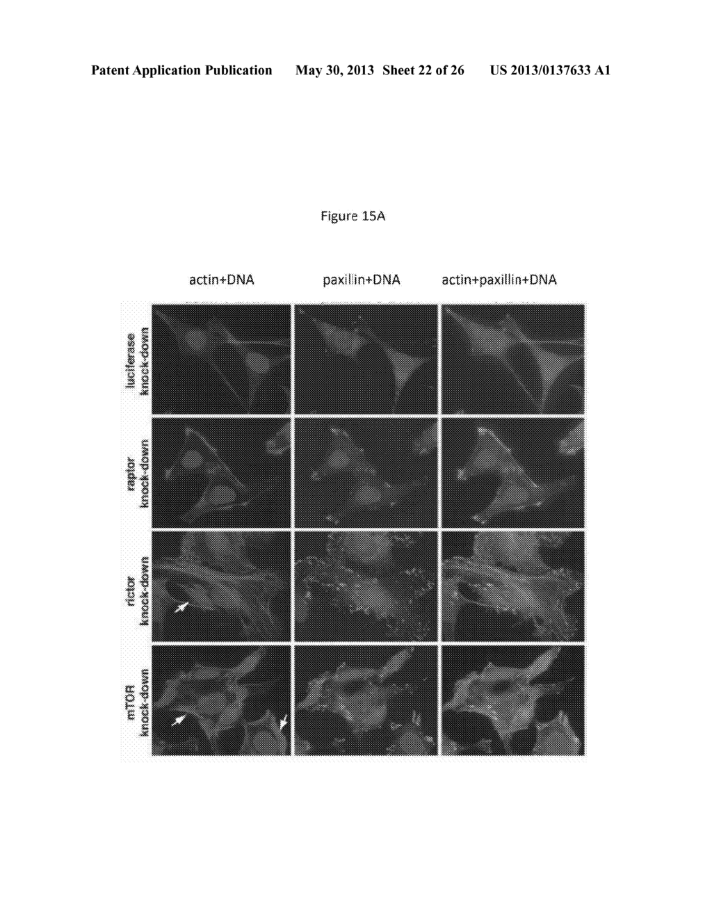 mTOR KINASE-ASSOCIATED PROTEINS - diagram, schematic, and image 23