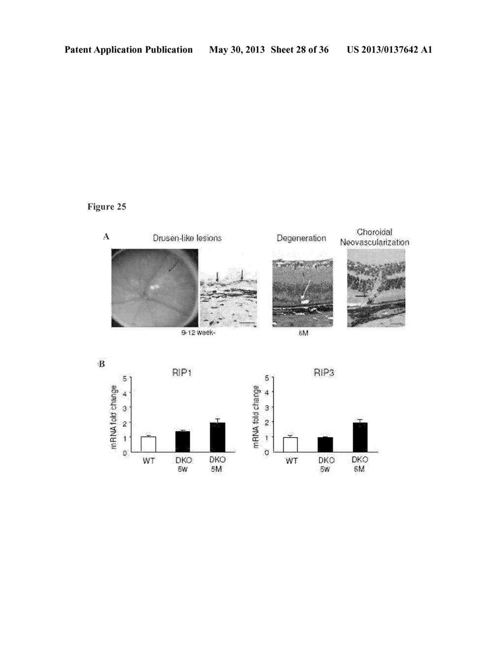 METHODS AND COMPOSITIONS FOR PRESERVING PHOTORECEPTOR AND RETINAL PIGMENT     EPITHELIAL CELLS - diagram, schematic, and image 29