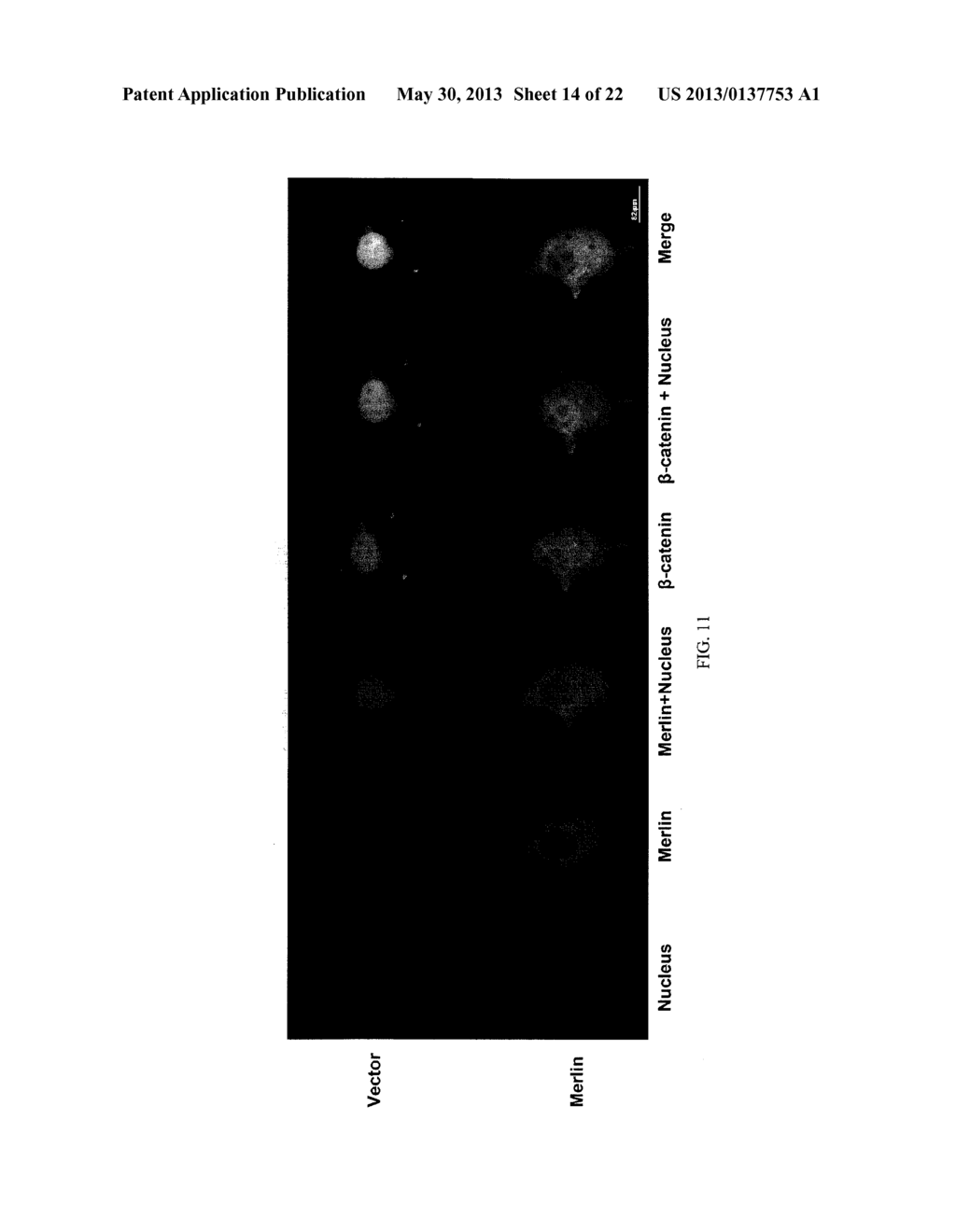 METHODS AND COMPOSITIONS FOR THE DIAGNOSIS AND TREATMENT OF BREAST CANCER - diagram, schematic, and image 15