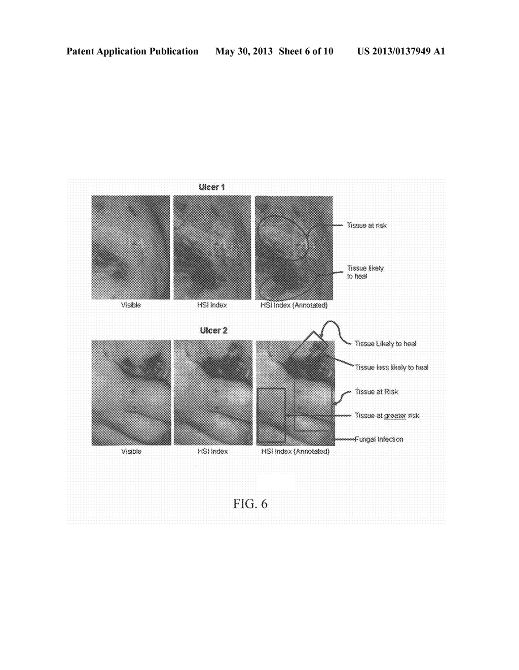 HYPERSPECTRAL IMAGING OF ANGIOGENESIS - diagram, schematic, and image 07