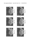 Devices, Systems, and Methods for Controlling Field of View in Imaging     Systems diagram and image