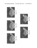 Devices, Systems, and Methods for Controlling Field of View in Imaging     Systems diagram and image