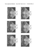 Devices, Systems, and Methods for Controlling Field of View in Imaging     Systems diagram and image