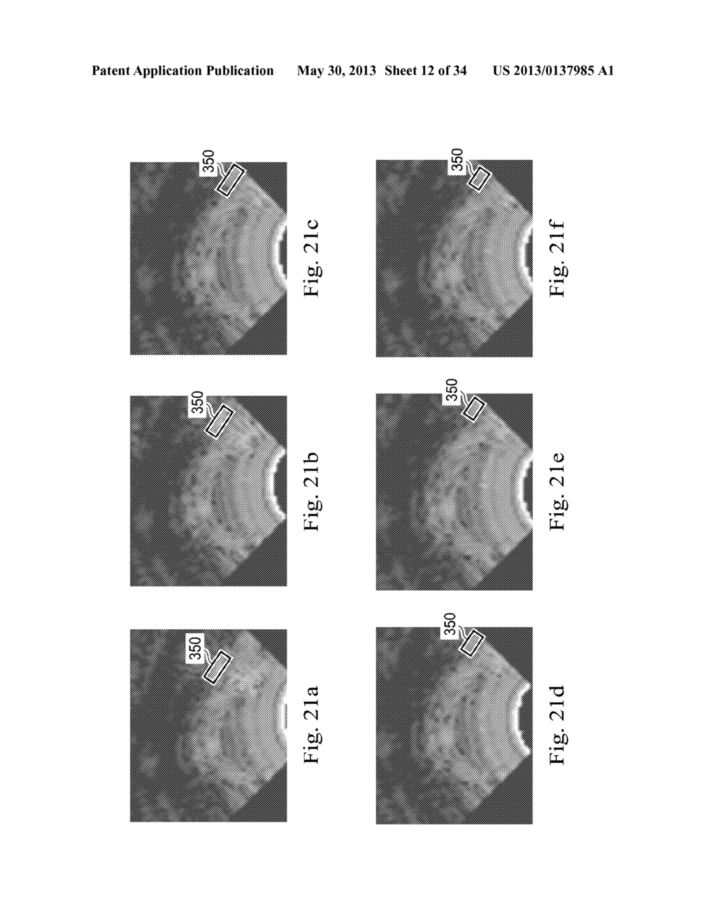 Devices, Systems, and Methods for Controlling Field of View in Imaging     Systems - diagram, schematic, and image 13