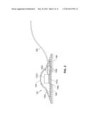 OPTICAL CAPSULE AND SPECTROSCOPIC METHOD FOR TREATING AND DIAGNOSING THE     INTESTINAL TRACT diagram and image