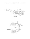 OPTICAL CAPSULE AND SPECTROSCOPIC METHOD FOR TREATING AND DIAGNOSING THE     INTESTINAL TRACT diagram and image