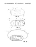 OPTICAL CAPSULE AND SPECTROSCOPIC METHOD FOR TREATING AND DIAGNOSING THE     INTESTINAL TRACT diagram and image