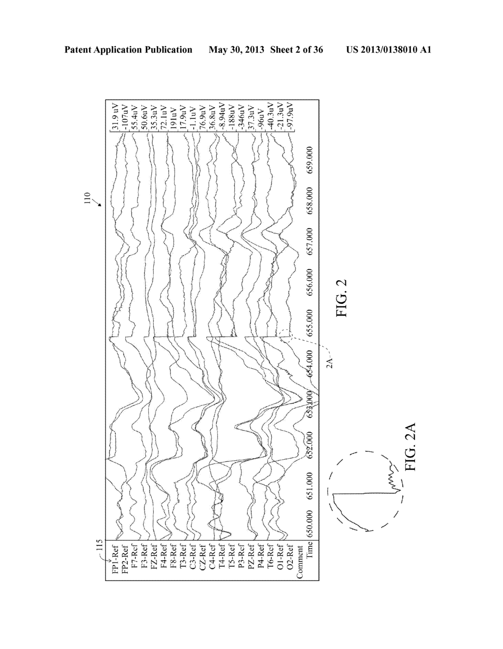 User Interface For Artifact Removal In An EEG - diagram, schematic, and image 03