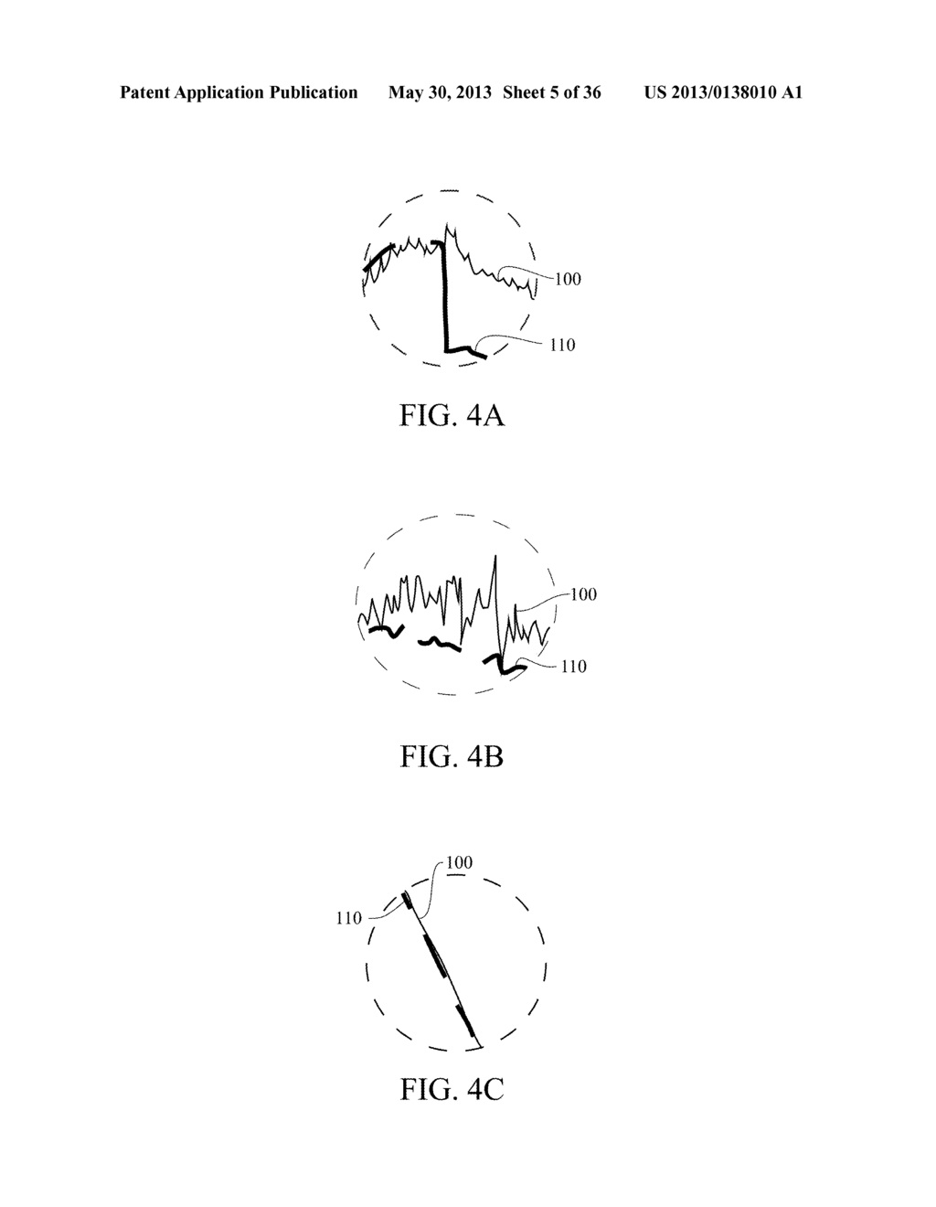 User Interface For Artifact Removal In An EEG - diagram, schematic, and image 06