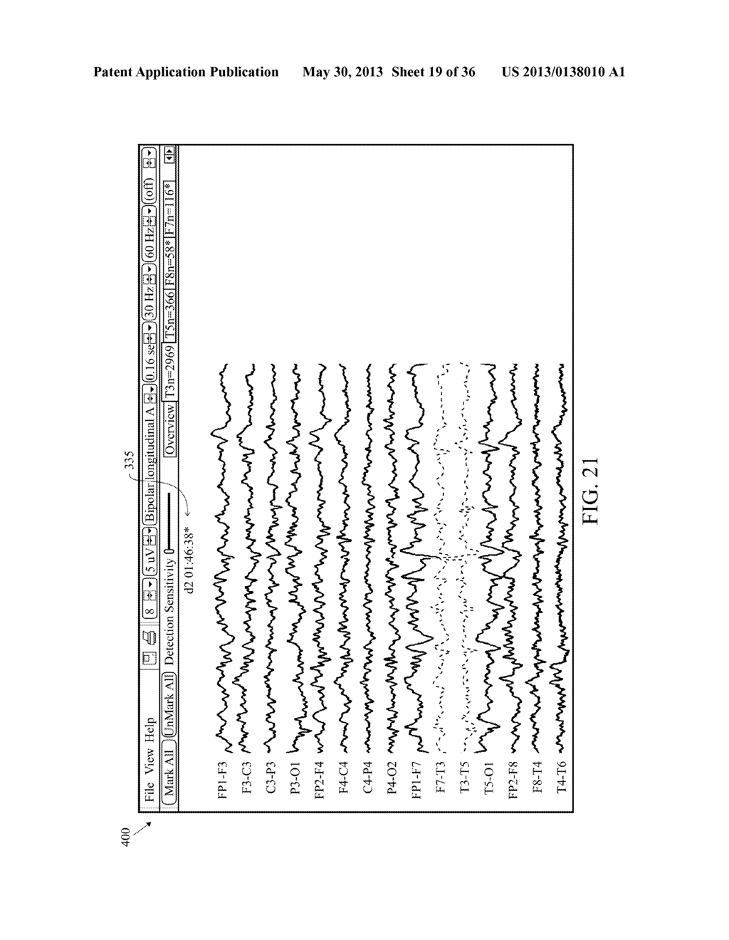 User Interface For Artifact Removal In An EEG - diagram, schematic, and image 20