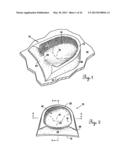 Lateral Support Craniocervical Orthosis and Method diagram and image