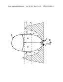 Lateral Support Craniocervical Orthosis and Method diagram and image