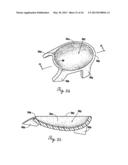 Lateral Support Craniocervical Orthosis and Method diagram and image