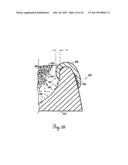 Lateral Support Craniocervical Orthosis and Method diagram and image