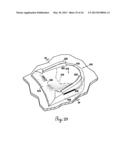 Lateral Support Craniocervical Orthosis and Method diagram and image