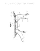 ANKLE-FOOT ORTHOTIC FOR TREATMENT OF FOOT DROP diagram and image