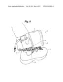 ANKLE-FOOT ORTHOTIC FOR TREATMENT OF FOOT DROP diagram and image