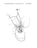 ANKLE-FOOT ORTHOTIC FOR TREATMENT OF FOOT DROP diagram and image