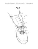 ANKLE-FOOT ORTHOTIC FOR TREATMENT OF FOOT DROP diagram and image