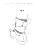 ANKLE-FOOT ORTHOTIC FOR TREATMENT OF FOOT DROP diagram and image