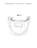 ANKLE-FOOT ORTHOTIC FOR TREATMENT OF FOOT DROP diagram and image