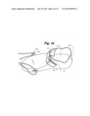 ANKLE-FOOT ORTHOTIC FOR TREATMENT OF FOOT DROP diagram and image