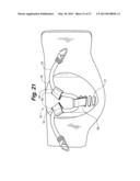 ANKLE-FOOT ORTHOTIC FOR TREATMENT OF FOOT DROP diagram and image