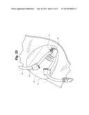 ANKLE-FOOT ORTHOTIC FOR TREATMENT OF FOOT DROP diagram and image