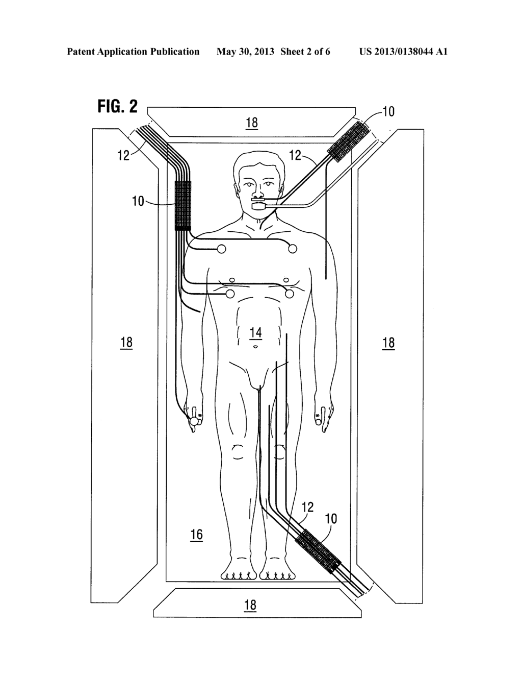 APPARATUS FOR SUPPORTING MEDICAL LINES - diagram, schematic, and image 03