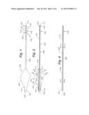 TISSUE TRANSFER CANNULA diagram and image