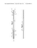 TISSUE TRANSFER CANNULA diagram and image